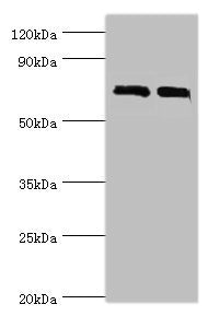 Western blot | All lanes: DHX58 antibody at 12μg/ml | Lane 1: 293T whole cell lysate | Lane 2: Rat kidney tissue | Secondary | Goat polyclonal to rabbit IgG at 1/10000 dilution | Predicted band size: 77 kDa | Observed band size: 77 kDaRabbit anti-Human DHX58 Polyclonal Antibody