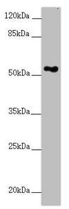 Western blot  | All lanes: FOXRED1 antibody at 5.28µg/ml + A549 whole cell lysate  | Secondary  | Goat polyclonal to rabbit IgG at 1/10000 dilution  | Predicted band size: 54, 31, 53 kDa  | Observed band size: 54 kDaRabbit anti-Human FOXRED1 Polyclonal Antibody