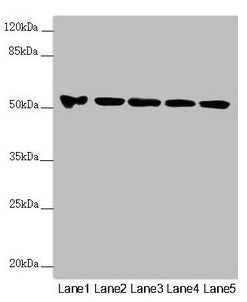 Western blot  | All lanes: FOXRED1 antibody at 5.8µg/ml  | Lane 1: A549 whole cell lysate  | Lane 2: A431 whole cell lysate  | Lane 3: Jurkat whole cell lysate  | Lane 4: Hela whole cell lysate  | Lane 5: HepG2 whole cell lysate  | Secondary  | Goat polyclonal to rabbit IgG at 1/10000 dilution  | Predicted band size: 54, 31, 53 kDa  | Observed band size: 54 kDaRabbit anti-Human FOXRED1 Polyclonal Antibody