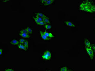 Immunofluorescent analysis of HepG2 cells using RAB39B Antibody at dilution of 1:100 and Alexa Fluor 488-congugated AffiniPure Goat Anti-Rabbit IgG(H+L)Rabbit anti-Human RAB39B Polyclonal Antibody