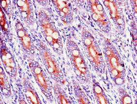 Immunohistochemistry of paraffin-embedded human small intestine tissue using the antibody at dilution of 1:100Rabbit anti-Human RAB39B Polyclonal Antibody