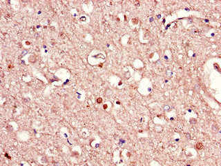 Immunohistochemistry of paraffin-embedded human brain tissue using RAB39B Antibody at dilution of 1:100Rabbit anti-Human RAB39B Polyclonal Antibody