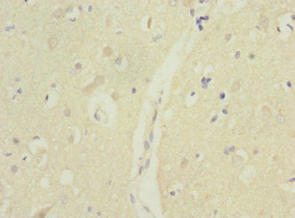 Immunohistochemistry of paraffin-embedded human brain tissue using MTERF3 Antibody at dilution of 1:100Rabbit anti-Human MTERF3 Polyclonal Antibody