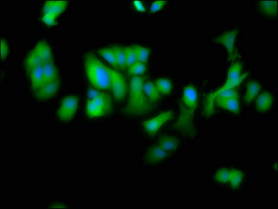 Immunofluorescence staining of MCF-7 cells with DTNBP1 Antibody at 1:100, counter-stained with DAPI. The cells were fixed in 4% formaldehyde, permeabilized using 0.2% Triton X-100 and blocked in 10% normal Goat Serum. The cells were then incubated with the antibody overnight at 4°C. The secondary antibody was Alexa Fluor 488-congugated AffiniPure Goat Anti-Rabbit IgG(H+L).Rabbit anti-Human DTNBP1 Polyclonal Antibody