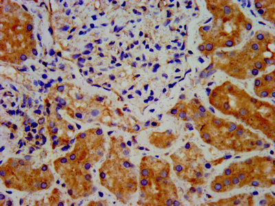 IHC image of the antibody diluted at 1:300 and staining in paraffin-embedded human kidney tissue performed on a Leica BondTM system. After dewaxing and hydration, antigen retrieval was mediated by high pressure in a citrate buffer (pH 6.0). Section was blocked with 10% normal goat serum 30min at RT. Then primary antibody (1% BSA) was incubated at 4°C overnight. The primary is detected by a biotinylated secondary antibody and visualized using an HRP conjugated SP system.Rabbit anti-Human DTNBP1 Polyclonal Antibody