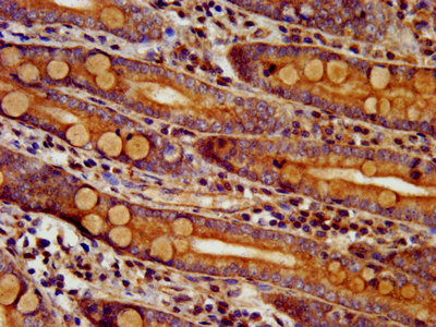 IHC image of DTNBP1 Antibody diluted at 1:300 and staining in paraffin-embedded human small intestine tissue performed on a Leica BondTM system. After dewaxing and hydration, antigen retrieval was mediated by high pressure in a citrate buffer (pH 6.0). Section was blocked with 10% normal goat serum 30min at RT. Then primary antibody (1% BSA) was incubated at 4°C overnight. The primary is detected by a biotinylated secondary antibody and visualized using an HRP conjugated SP system.Rabbit anti-Human DTNBP1 Polyclonal Antibody