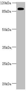 Western blot | All lanes: CEP95 antibody at 2.67 μg/ml + Mouse heart tissue | Secondary | Goat polyclonal to rabbit IgG at 1/10000 dilution | Predicted band size: 96, 77 kDa | Observed band size: 96 kDaRabbit anti-Human CEP95 Polyclonal Antibody