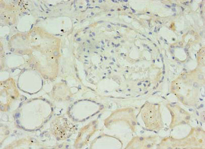 Immunohistochemistry of paraffin-embedded human kidney tissue using the antibody at dilution of 1:100