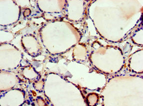 Immunohistochemistry of paraffin-embedded human thyroid tissue using FUBP3 Antibody at dilution of 1:100Rabbit anti-Human FUBP3 Polyclonal Antibody