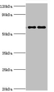 Western blot | All lanes: Far upstream element-binding protein 3 antibody at 2μg/ml | Lane 1: Hela whole cell lysate | Lane 2: HepG2 whole cell lysate | Secondary | Goat polyclonal to rabbit IgG at 1/10000 dilution | Predicted band size: 62, 29 kDa | Observed band size: 62 kDaRabbit anti-Human FUBP3 Polyclonal Antibody