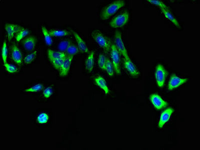 Immunofluorescent analysis of HepG2 cells using FAR2 Antibody at dilution of 1:100 and Alexa Fluor 488-congugated AffiniPure Goat Anti-Rabbit IgG(H+L)Rabbit anti-Human FAR2 Polyclonal Antibody
