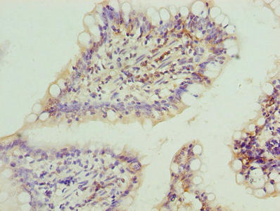 Immunohistochemistry of paraffin-embedded human small intestine tissue using the antibody at dilution of 1:100Rabbit anti-Human FAR2 Polyclonal Antibody