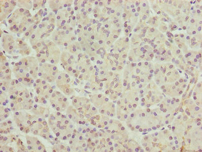 Immunohistochemistry of paraffin-embedded human pancreatic tissue using FAR2 Antibody at dilution of 1:100Rabbit anti-Human FAR2 Polyclonal Antibody