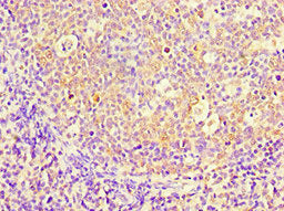 Immunohistochemistry of paraffin-embedded human tonsil tissue using PBK Antibody at dilution of 1:100Rabbit anti-Human PBK Polyclonal Antibody