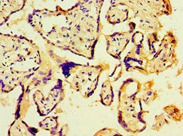 Immunohistochemistry of paraffin-embedded human placenta tissue using PBK Antibody at dilution of 1:100Rabbit anti-Human PBK Polyclonal Antibody