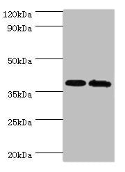 Western blot | All lanes: PBK antibody at 6μg/ml | Lane 1: Hela whole cell lysate | Lane 2: Mouse gonad tissue | Secondary | Goat polyclonal to rabbit IgG at 1/10000 dilution | Predicted band size: 37, 38 kDa | Observed band size: 37 kDaRabbit anti-Human PBK Polyclonal Antibody