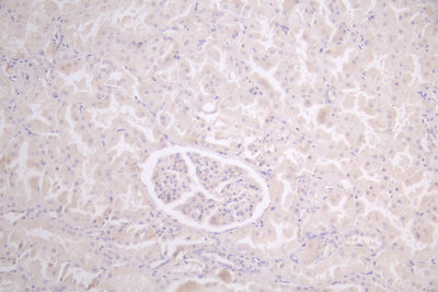 IHC image of PRIMPOL Antibody diluted at 1:50 and staining in paraffin-embedded human kidney tissue performed on a Leica BondTM system. After dewaxing and hydration, antigen retrieval was mediated by high pressure in a citrate buffer (pH 6.0). Section was blocked with 10% normal goat serum 30min at RT. Then primary antibody (1% BSA) was incubated at 4°C overnight. The primary is detected by a Goat anti-rabbit polymer IgG labeled by HRP and visualized using 0.05% DAB.Rabbit anti-Human PRIMPOL Polyclonal Antibody