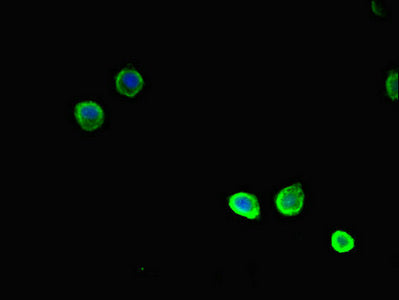 Immunofluorescent analysis of HepG2 cells using TSNARE1 Antibody at dilution of 1:100 and Alexa Fluor 488-congugated AffiniPure Goat Anti-Rabbit IgG(H+L)Rabbit anti-Human TSNARE1 Polyclonal Antibody