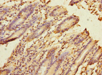 Immunohistochemistry of paraffin-embedded human duodenal tissue using FRMD6 Antibody at dilution of 1:100Rabbit anti-Human FRMD6 Polyclonal Antibody
