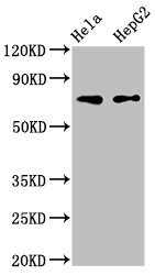 Western Blot  | Positive WB detected in: Hela whole cell lysate, HepG2 whole cell lysate  | All lanes: FRMD6 antibody at 3µg/ml  | Secondary  | Goat polyclonal to rabbit IgG at 1/50000 dilution  | Predicted band size: 73, 71, 30 kDa  | Observed band size: 73 kDaRabbit anti-Human FRMD6 Polyclonal Antibody