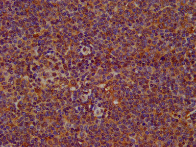 IHC image of the antibody diluted at 1:200 and staining in paraffin-embedded human lymph node tissue performed on a Leica BondTM system. After dewaxing and hydration, antigen retrieval was mediated by high pressure in a citrate buffer (pH 6.0). Section was blocked with 10% normal goat serum 30min at RT. Then primary antibody (1% BSA) was incubated at 4°C overnight. The primary is detected by a biotinylated secondary antibody and visualized using an HRP conjugated SP system.Rabbit anti-Human SERPINB12 Polyclonal Antibody