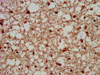 IHC image of SERPINB12 Antibody diluted at 1:200 and staining in paraffin-embedded human brain tissue performed on a Leica BondTM system. After dewaxing and hydration, antigen retrieval was mediated by high pressure in a citrate buffer (pH 6.0). Section was blocked with 10% normal goat serum 30min at RT. Then primary antibody (1% BSA) was incubated at 4°C overnight. The primary is detected by a biotinylated secondary antibody and visualized using an HRP conjugated SP system.Rabbit anti-Human SERPINB12 Polyclonal Antibody