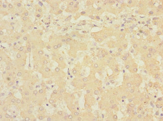 Immunohistochemistry of paraffin-embedded human liver tissue using RCHY1 Antibody at dilution of 1:100