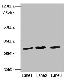 Western blot  | All lanes: RCHY1 antibody at 3.98µg/ml  | Lane 1: SH-SY5Y whole cell lysate  | Lane 2: 293T whole cell lysate  | Lane 3: Hela whole cell lysate  | Secondary  | Goat polyclonal to rabbit IgG at 1/10000 dilution  | Predicted band size: 31, 29, 21, 22, 9, 28, 26, 25 kDa  | Observed band size: 31 kDa