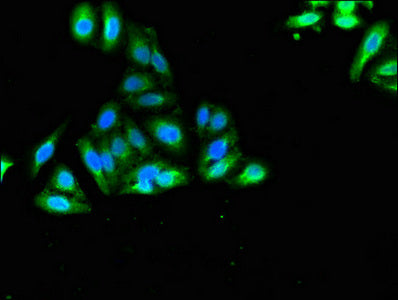 Immunofluorescent analysis of HepG2 cells using SORCS2 Antibody at dilution of 1:100 and Alexa Fluor 488-congugated AffiniPure Goat Anti-Rabbit IgG(H+L)Rabbit anti-Human SORCS2 Polyclonal Antibody