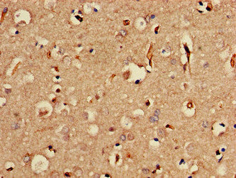 Immunohistochemistry of paraffin-embedded human brain tissue using the antibody at dilution of 1:100Rabbit anti-Human SORCS2 Polyclonal Antibody