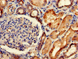 Immunohistochemistry of paraffin-embedded human kidney tissue using SORCS2 Antibody at dilution of 1:100Rabbit anti-Human SORCS2 Polyclonal Antibody