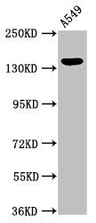 Western Blot | Positive WB detected in: A549 whole cell lysate | All lanes: PLIN4 antibody at 2.7μg/ml | Secondary | Goat polyclonal to rabbit IgG at 1/50000 dilution | Predicted band size: 135, 141 kDa | Observed band size: 135 kDaRabbit anti-Human PLIN4 Polyclonal Antibody