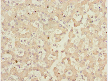 Immunohistochemistry of paraffin-embedded human liver tissue using IWS1 Antibody at dilution of 1:100