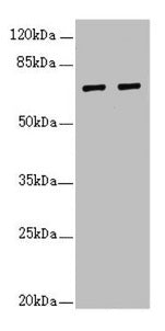 Western blot  | All lanes: IWS1 antibody at 3.84µg/ml  | Lane 1: 293T whole cell lysate  | Lane 2: Jurkat whole cell lysate  | Secondary  | Goat polyclonal to rabbit IgG at 1/10000 dilution  | Predicted band size: 92, 57, 70 kDa  | Observed band size: 70 kDa