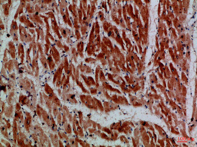 Immunohistochemical analysis of paraffin-embedded Human-heart, antibody was diluted at 1:100Rabbit anti-Human MYH6/MYH7 Polyclonal Antibody