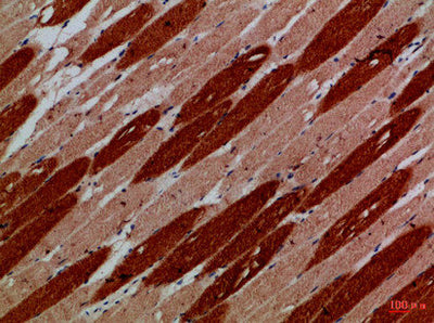Immunohistochemical analysis of paraffin-embedded Human-skeletal-muscle, antibody was diluted at 1:100Rabbit anti-Human MYH6/MYH7 Polyclonal Antibody