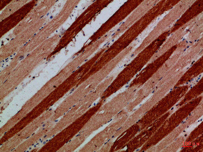 Immunohistochemical analysis of paraffin-embedded Human-skeletal-muscle, antibody was diluted at 1:100Rabbit anti-Human MYH6/MYH7 Polyclonal Antibody
