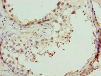 Immunohistochemistry of paraffin-embedded human testis tissue using CPXCR1 Antibody at dilution of 1:100Rabbit anti-Human CPXCR1 Polyclonal Antibody