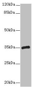 Western blot  | All lanes: CPXCR1 antibody at 5µg/ml + Mouse brain tissue  | Secondary  | Goat polyclonal to rabbit IgG at 1/10000 dilution  | Predicted band size: 35 kDa  | Observed band size: 35 kDaRabbit anti-Human CPXCR1 Polyclonal Antibody