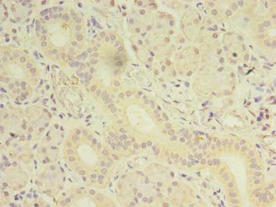 Immunohistochemistry of paraffin-embedded human pancreatic tissue using OSR2 Antibody at dilution of 1:100Rabbit anti-Human OSR2 Polyclonal Antibody