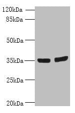 Western blot  | All lanes: OSR2 antibody at 7µg/ml  | Lane 1: Jurkat whole cell lysate  | Lane 2: Hela whole cell lysate  | Secondary  | Goat polyclonal to rabbit IgG at 1/10000 dilution  | Predicted band size: 36, 31, 49 kDa  | Observed band size: 36 kDaRabbit anti-Human OSR2 Polyclonal Antibody