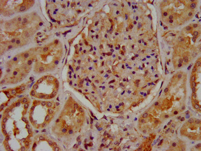 IHC image of MUC20 Antibody diluted at 1:600 and staining in paraffin-embedded human kidney tissue performed on a Leica BondTM system. After dewaxing and hydration, antigen retrieval was mediated by high pressure in a citrate buffer (pH 6.0). Section was blocked with 10% normal goat serum 30min at RT. Then primary antibody (1% BSA) was incubated at 4°C overnight. The primary is detected by a biotinylated secondary antibody and visualized using an HRP conjugated SP system.Rabbit anti-Human MUC20 Polyclonal Antibody