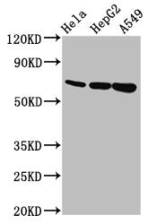 Western Blot  | Positive WB detected in: Hela whole cell lysate, HepG2 whole cell lysate, A549 whole cell lysate  | All lanes: MUC20 antibody at 5.6µg/ml  | Secondary  | Goat polyclonal to rabbit IgG at 1/50000 dilution  | Predicted band size: 72, 69 kDa  | Observed band size: 72 kDaRabbit anti-Human MUC20 Polyclonal Antibody