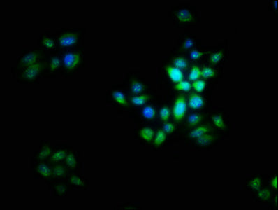 Immunofluorescence staining of PC-3 cells with the antibody at 1:16, counter-stained with DAPI. The cells were fixed in 4% formaldehyde, permeabilized using 0.2% Triton X-100 and blocked in 10% normal Goat Serum. The cells were then incubated with the antibody overnight at 4°C. The secondary antibody was Alexa Fluor 488-congugated AffiniPure Goat Anti-Rabbit IgG(H+L).
