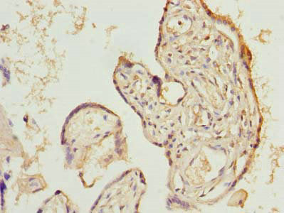 Immunohistochemistry of paraffin-embedded human placenta tissue using LIX1 Antibody at dilution of 1:100