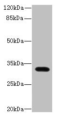 Western blot  | All lanes: LIX1 antibody at 0.5µg/ml + Mouse heart tissue  | Secondary  | Goat polyclonal to rabbit IgG at 1/10000 dilution  | Predicted band size: 32 kDa  | Observed band size: 32 kDa