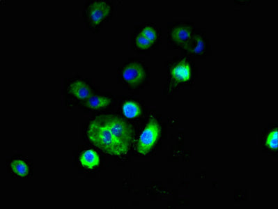 Immunofluorescent analysis of A431 cells using the antibody at dilution of 1:100 and Alexa Fluor 488-congugated AffiniPure Goat Anti-Rabbit IgG(H+L)Rabbit anti-Human RNF182 Polyclonal Antibody