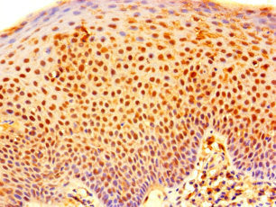 Immunohistochemistry of paraffin-embedded human tonsil tissue using RNF182 Antibody at dilution of 1:100Rabbit anti-Human RNF182 Polyclonal Antibody