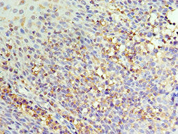 Immunohistochemistry of paraffin-embedded human tonsil tissue using IL22RA1 Antibody at dilution of 1:100Rabbit anti-Human IL22RA1 Polyclonal Antibody