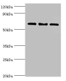Western blot | All lanes: IL22RA1 antibody at 10μg/ml | Lane 1: Mouse spleen tissue | Lane 2: HepG2 whole cell lysate | Lane 3: 293T whole cell lysate | Secondary | Goat polyclonal to rabbit IgG at 1/10000 dilution | Predicted band size: 63 kDa | Observed band size: 63 kDaRabbit anti-Human IL22RA1 Polyclonal Antibody